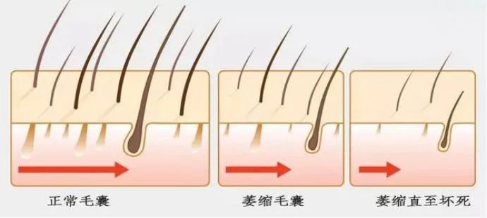 38cff7b4e4a09c11c43d4d2440b6c2c9_640_wx_fmt=jpeg&wxfrom=5&wx_lazy=1&wx_co=1 图片